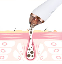 Load image into Gallery viewer, 4 in 1 Body Guasha Cupping Blackhead Remover Machine | Pharmacy
