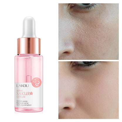 1PC Sakura Face Serum Shrink Pores Remove Acne | Pharmacy