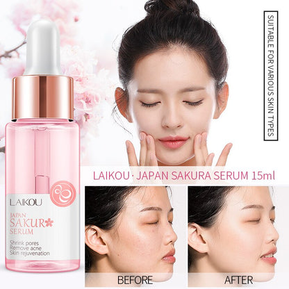 1PC Sakura Face Serum Shrink Pores Remove Acne | Pharmacy