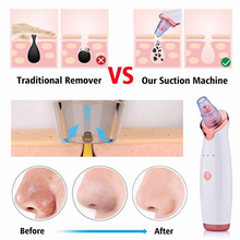 Load image into Gallery viewer, Electric Skin blackhead Vacuum Facial Blackhead Remover
